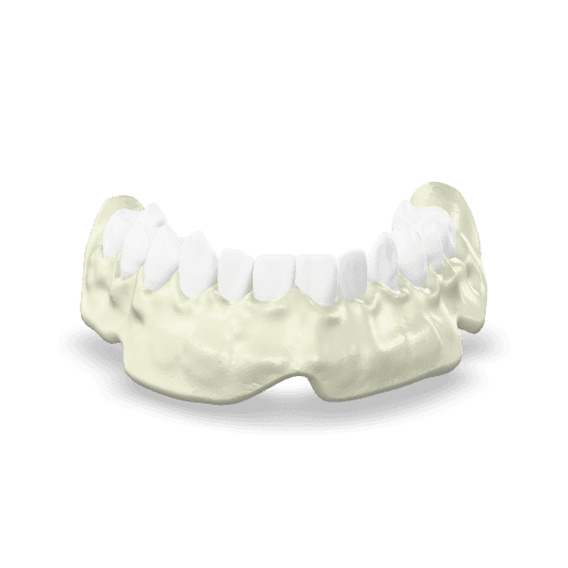 Full Contour Zirconia