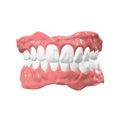 Acrylic Denture