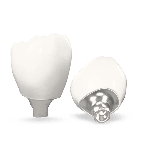 Screwmentable Crown Abutment with Screw Channel Crown