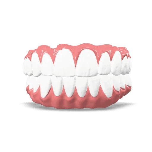 Screw Retained Zirconia Bridge